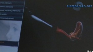 imagen-2