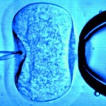 Niños concebidos por FIV podrían sufrir alteraciones cardiovasculares