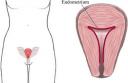 factor-uterino1_thumbnail1