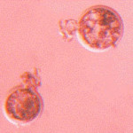 La obtención de ovocitos es una de las fases más avanzadas de la fecundación in vitro.