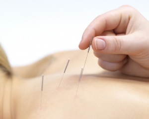 Fertilidad y acupuntura